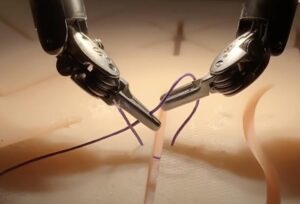 a surgical robot suturing a patient after a procedure.