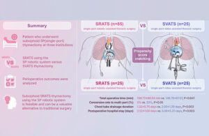 A graphical abstract of the research, showing a summary and an illustration for propensity score matching.