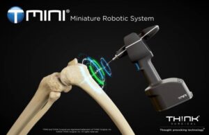 An illustration of THINK Surgical's TMINI Miniature Robotic System examining knee bones. It works with Zimmer Biomet's Persona system.